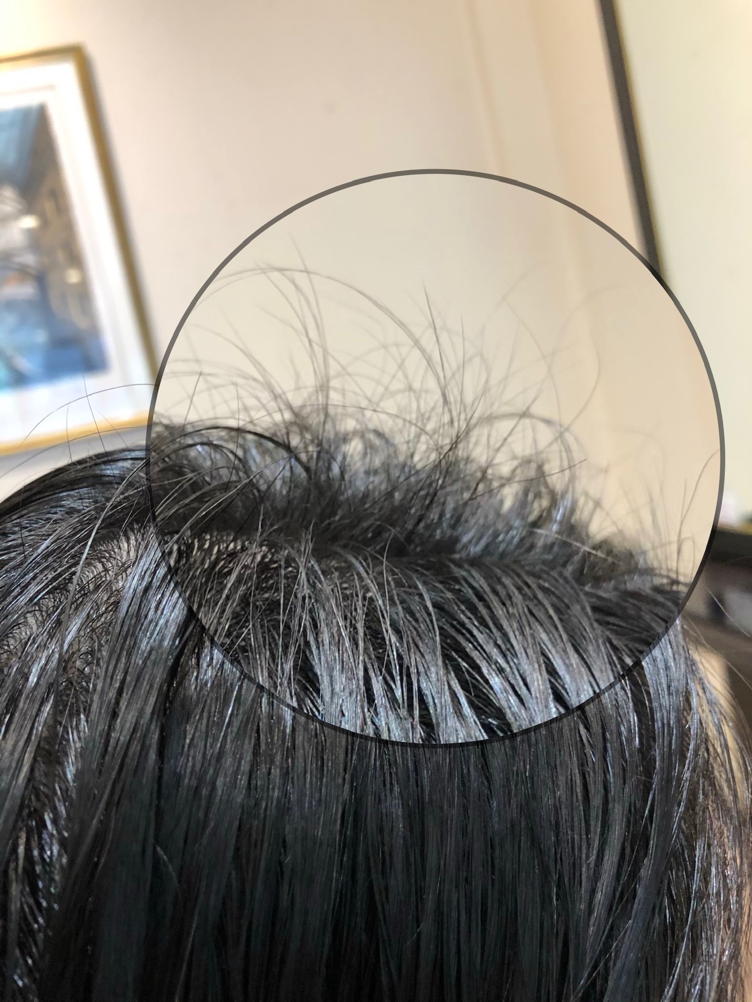 女性のための育毛 豊髪美髪メニュー 施術例 6週間後の様子 | 錦糸町の髪質改善と縮毛矯正のヘアサロンTravis(トラヴィス)